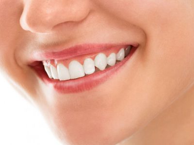 טיפולי שיניים בהרדמה מלאה מה היתרונות