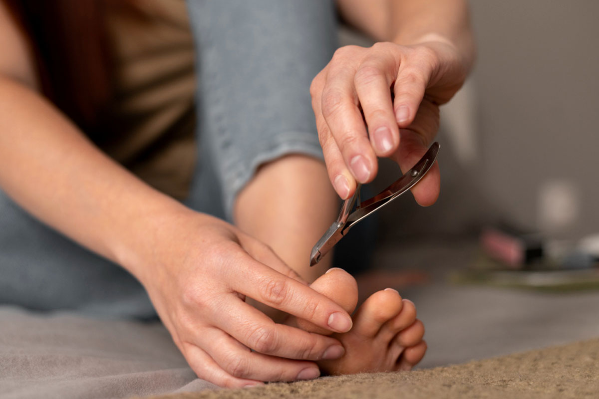 5 דרכים יעילות לטיפול טבעי בציפורן חודרנית